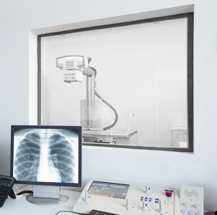 Mugurkaula rentgenogrāfija - galvenā osteohondrozes diagnostikas metode