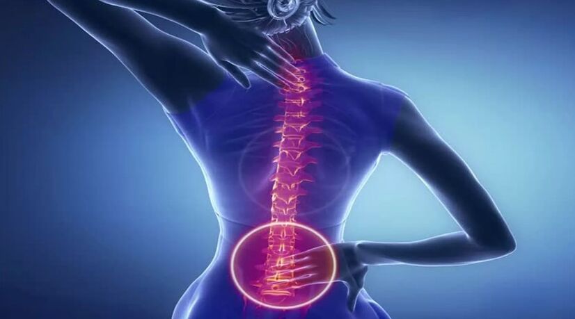 Mugurkaula osteohondroze