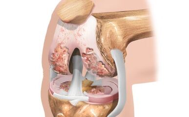Ligamentu shēma