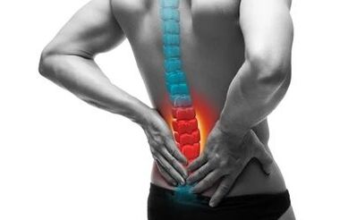 Osteohondroze ir mugurkaula slimība