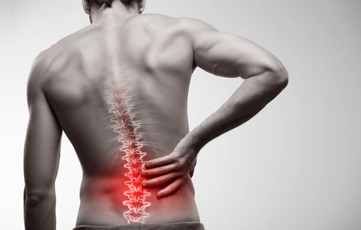 sāpes muguras lejasdaļā osteohondrozes dēļ